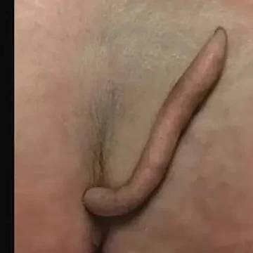 Bebé nació con cola de seis cm