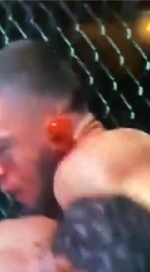 Peleador de UFC casi pierde una oreja