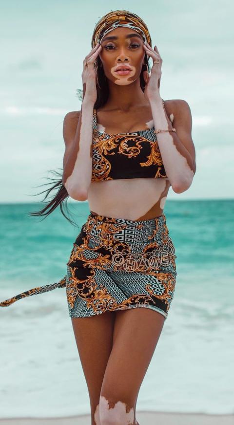 Winnie Harlow es una modelo que rompe los estereotipos