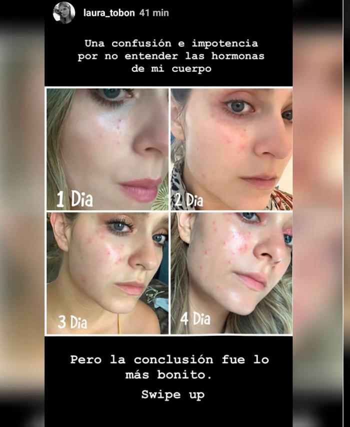 Cara de Laura Tobón afectada