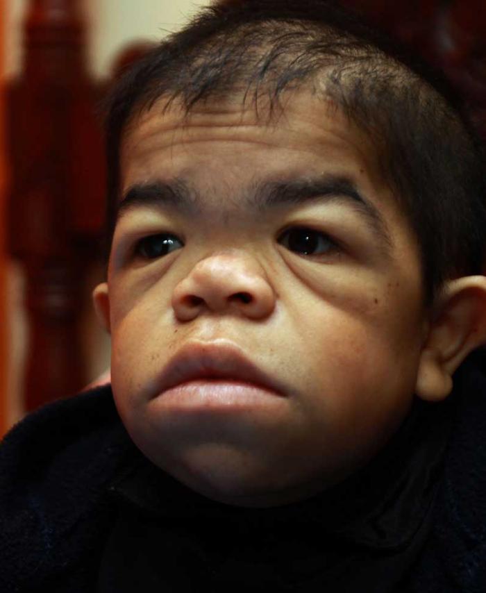 Edward Niño, el colombiano que vuelve a ser el hombre más bajo del mundo